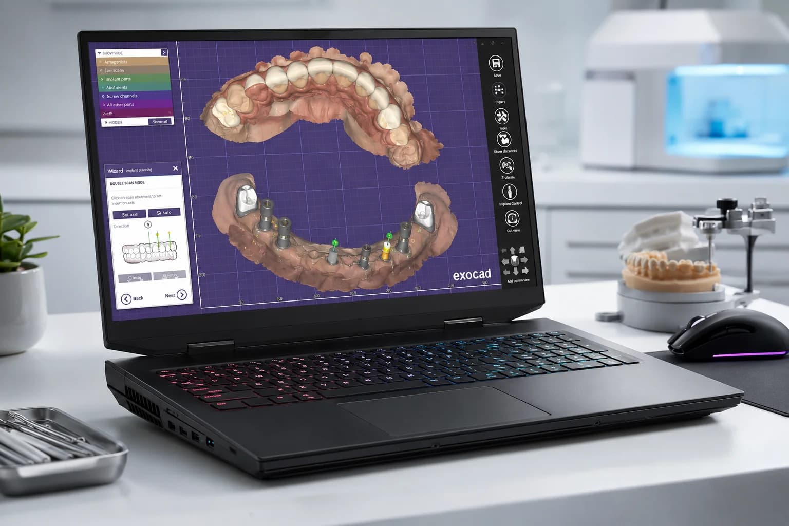 Diseño dental digital en Exocad para curso de flujo digital