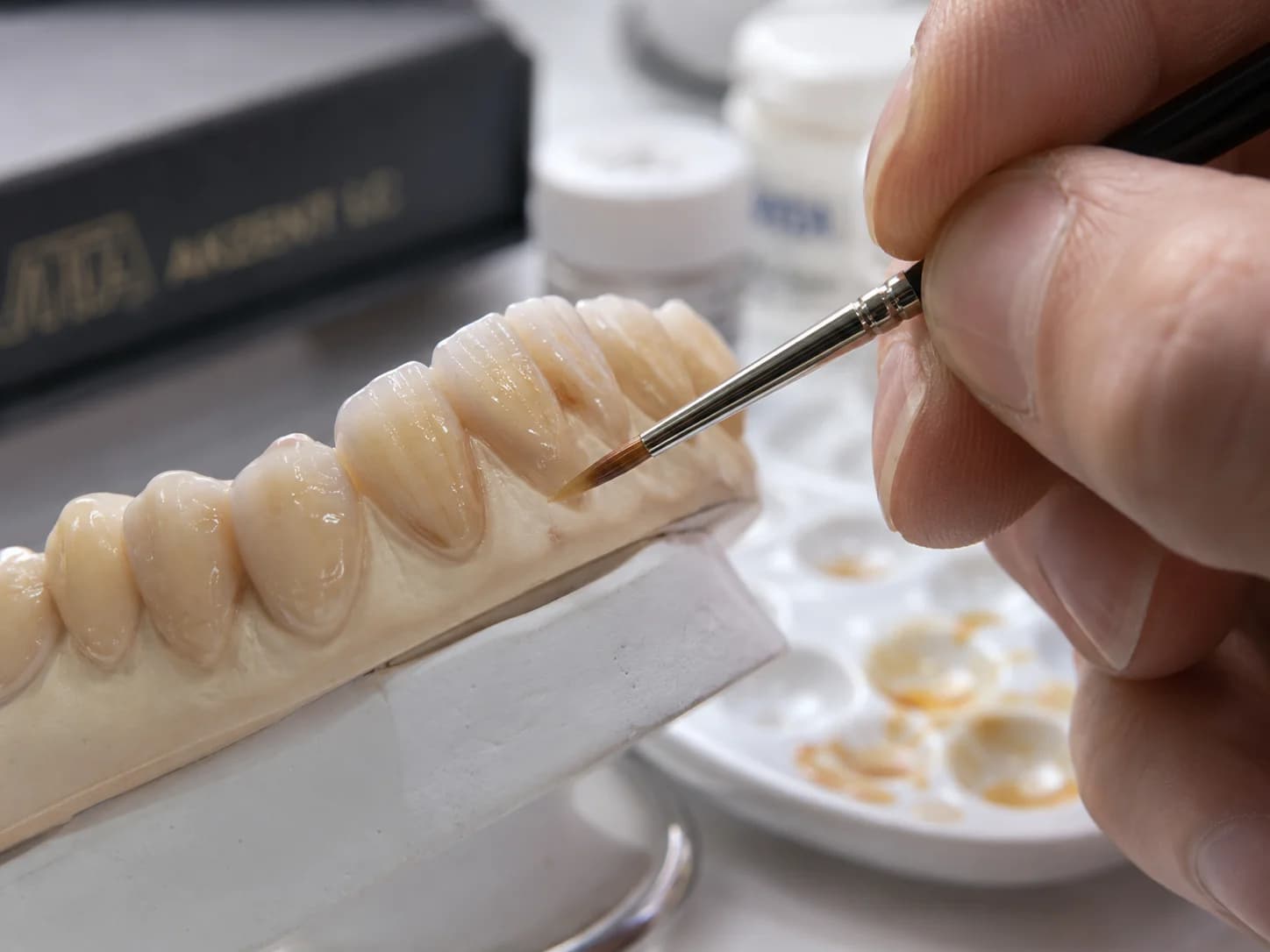 Maquillaje dental aplicado a provisionales impresos en resina