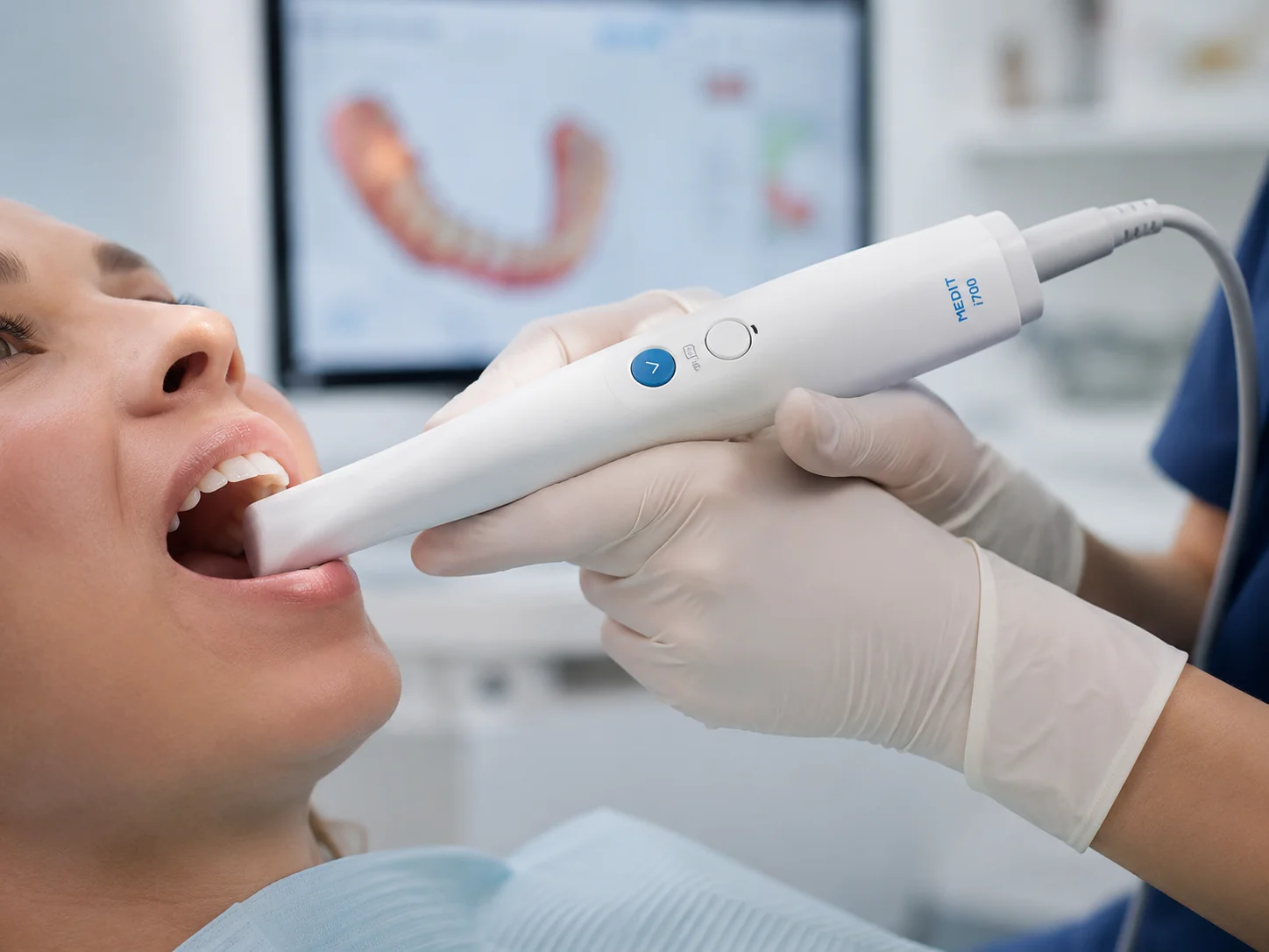 Escáner intraoral Medit usado en flujo digital dental