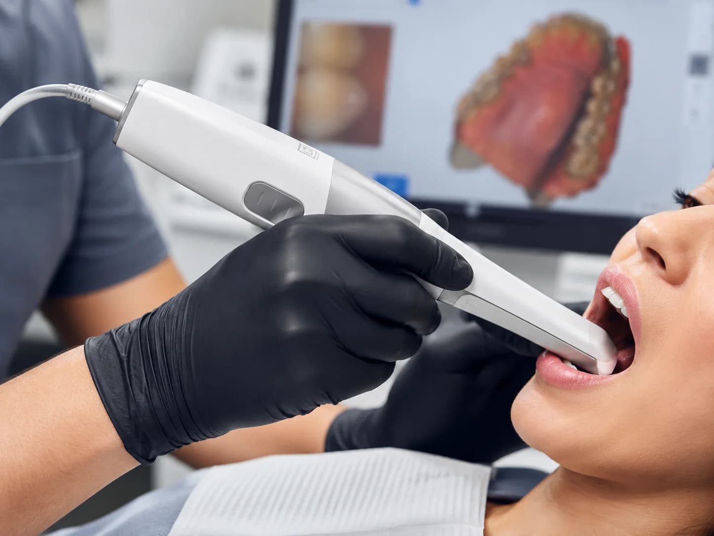 Escáner SEED Scan para flujo digital dental